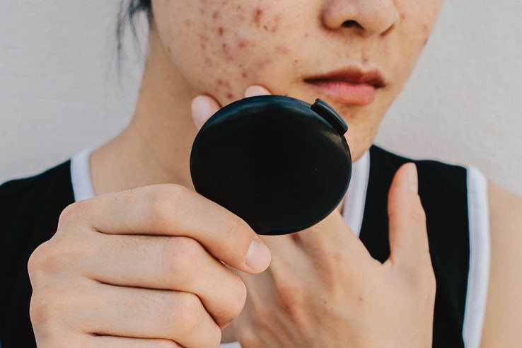 How Do Anxiety and Stress Affect the Skin? An Expert Weighs In