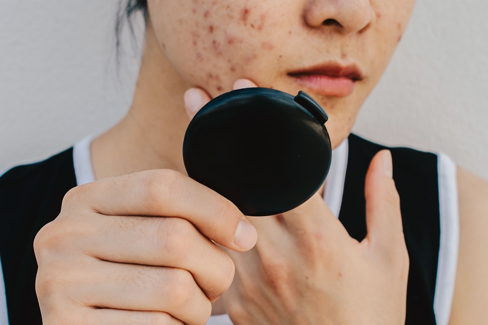 skincare acne stress anxiety wellness mental health hand mirror
