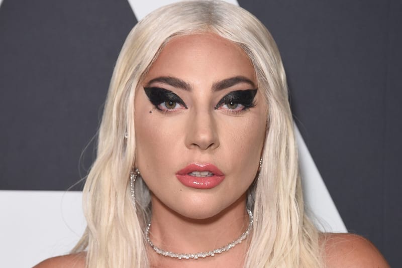 UPDATE: Lady Gaga's Dogs Have Been Returned Unharmed