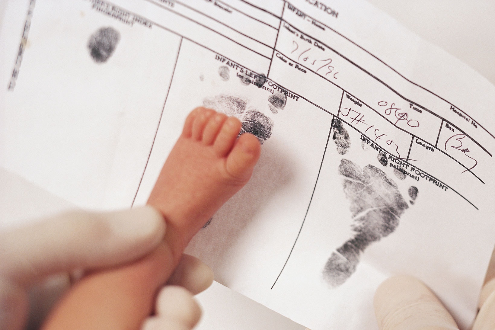 baby birth certificates remove sex designation american medical association ama info