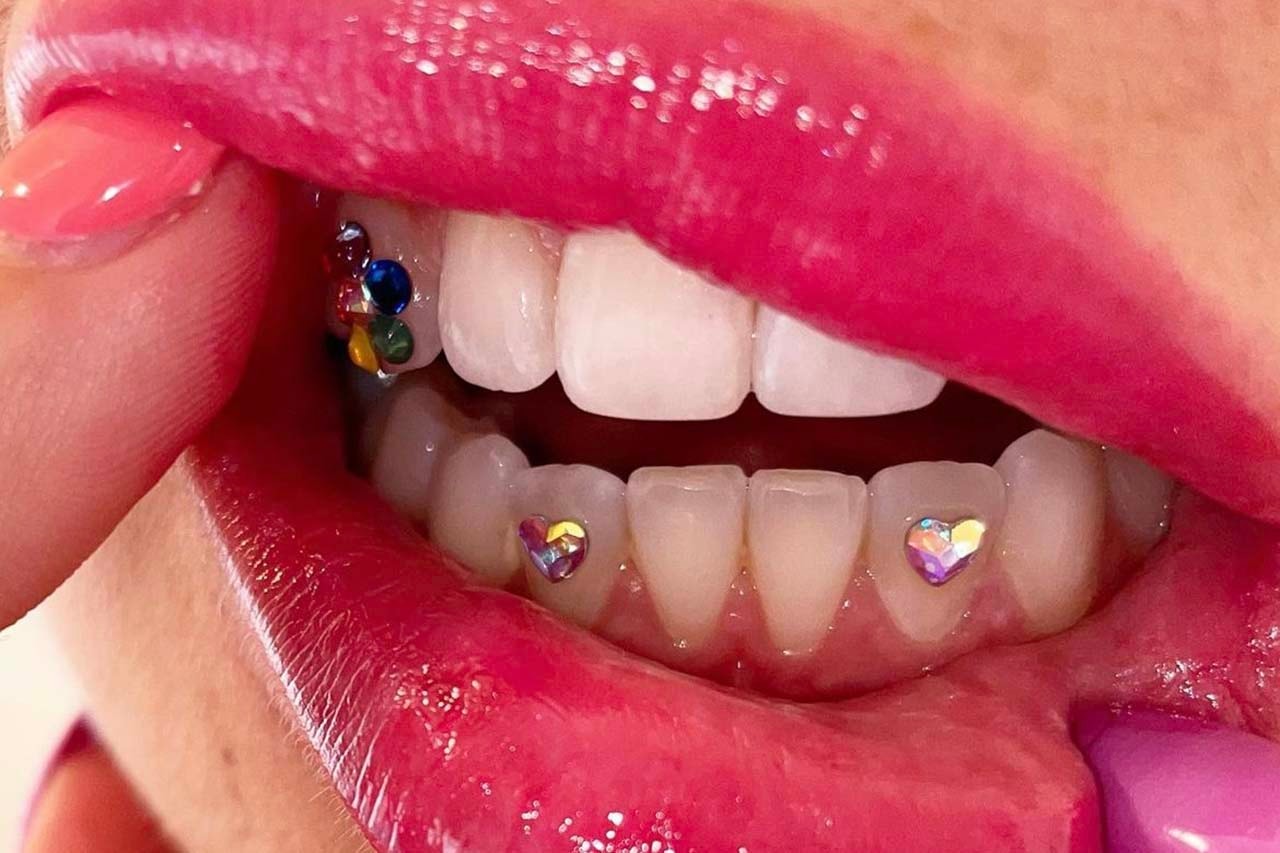 These bedazzled tooth gems are autumn's hottest Y2K accessory
