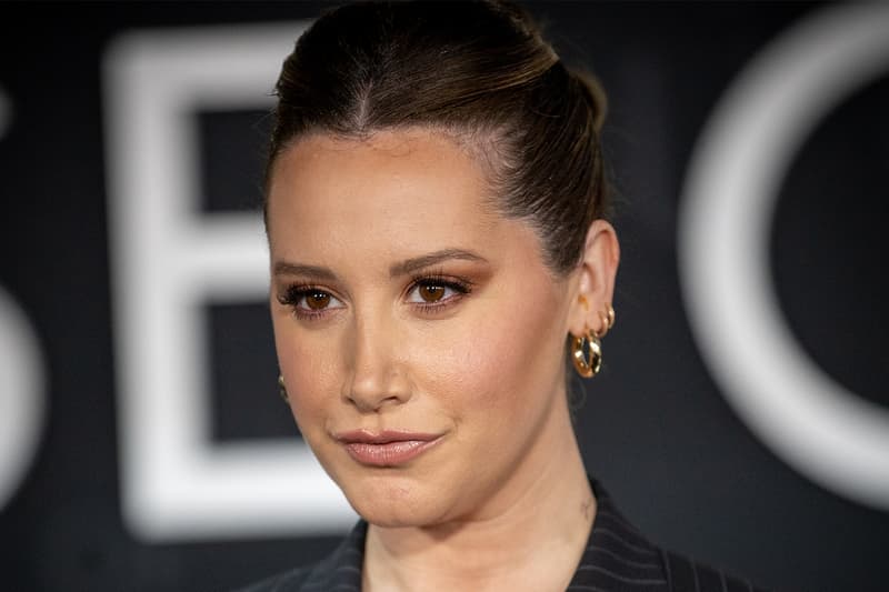 Ashley Tisdale alopecia diagnosis instagram frenshe