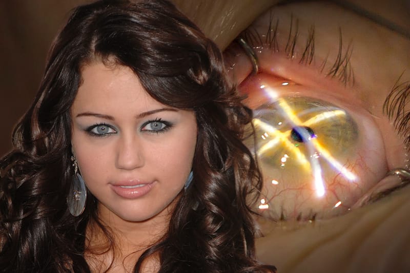 Is Changing Your Eye Color Worth Going Blind?