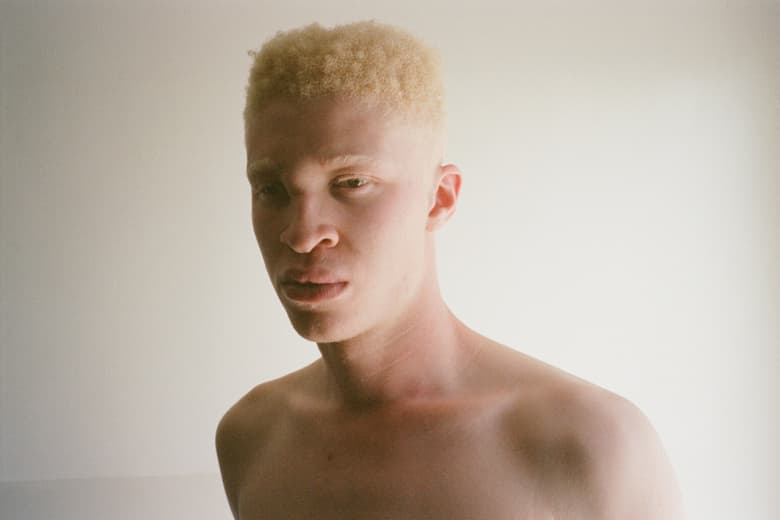 THROUGH THE LENS: Chris Shonting