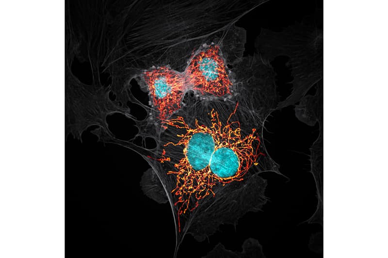 ニコン Nikon が主催する顕微鏡写真コンテスト “2019 Small World Photography Competition” の全受賞作品が発表 nikon small world photography winning images