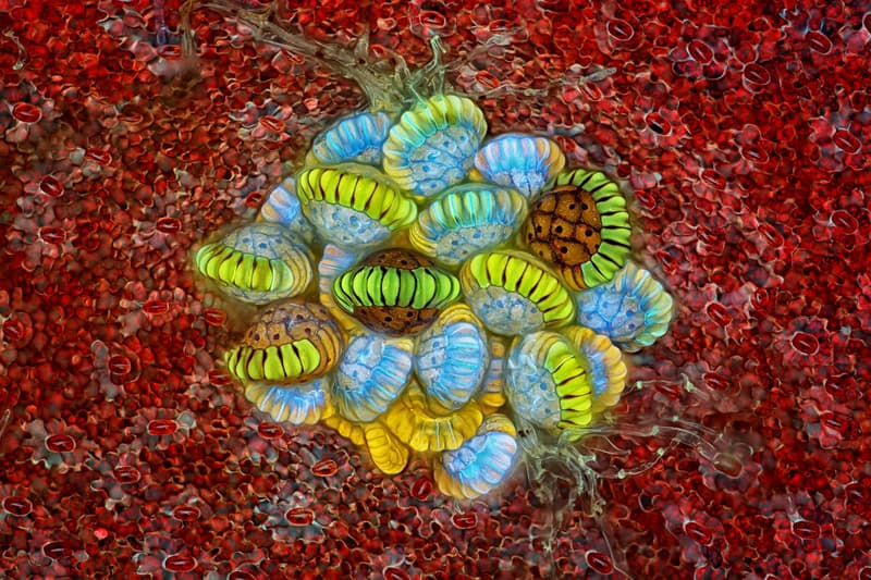 니콘 현미경 사진 공모전 '2018 스몰 월드 콘테스트' 수상작 2018 Nikon Small World Photomicrography competition