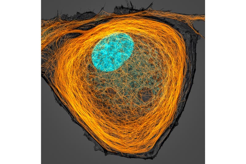 니콘, ‘2020 스몰 월드 사진 공모전' 수상작 공개, 포토그래퍼, 다이엘 카스트라노바, 현미경