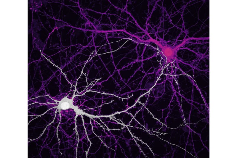 니콘, ‘2020 스몰 월드 사진 공모전' 수상작 공개, 포토그래퍼, 다이엘 카스트라노바, 현미경