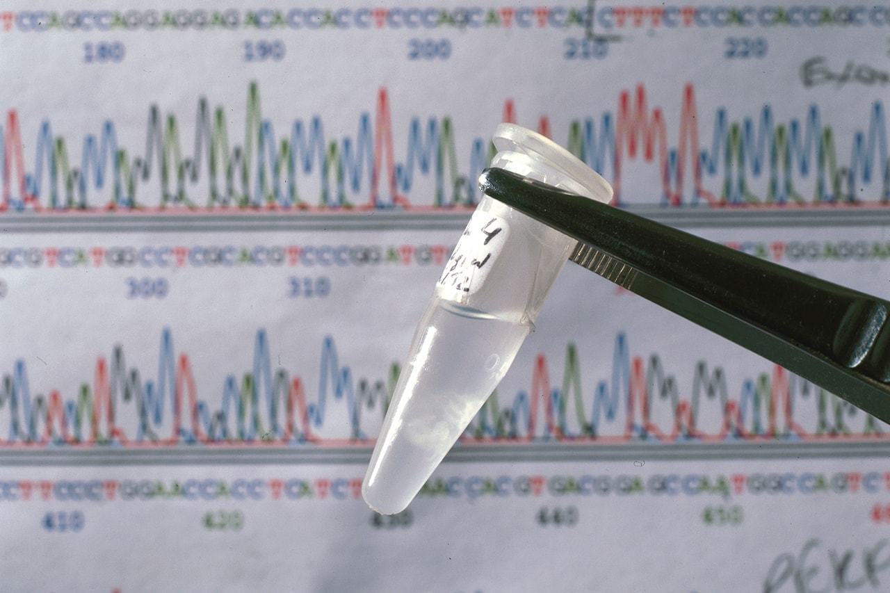 유전자가 비슷한 사람들끼리 교류하는 새로운 SNS가 출시된다, DNA, 유전적 관계망 서비스, 이원다이애그노믹스