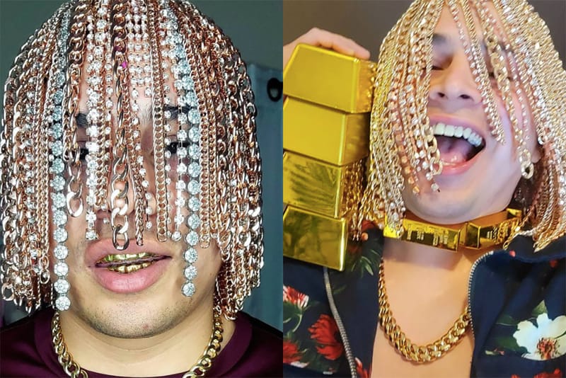 액세서리 이식 끝은 어디? 두피에 금 사슬 이식한 래퍼가 등장했다