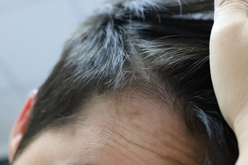 다이슨이 조사한 '한국인 평균 두피 모발 밀도'는?