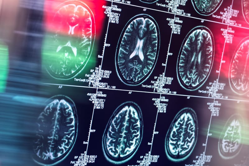 사람의 생각을 문장으로 나타내는 AI 모델이 나왔다