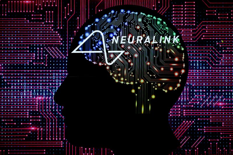 미국 FDA가 뉴럴링크의 뇌에 이식하는 컴퓨터 칩 임상 시험을 승인했다