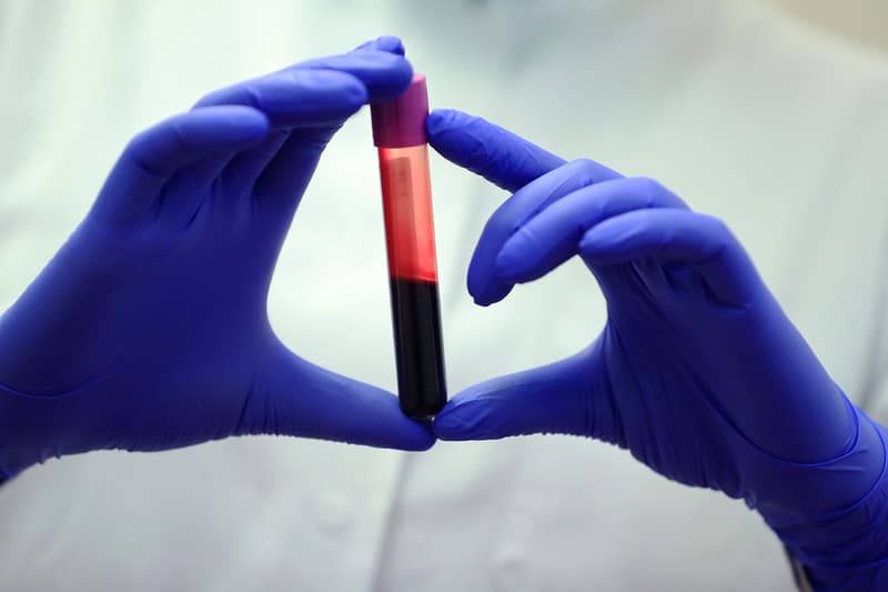p형 혈액형을 보유한 사람에게서 데이터베이스에 없는 새로운 유전자 서열이 발견됐다, china, bloodtype, p blood, gene, dna, 희귀 혈액형, 희귀 유전자, 희귀 특징, 희귀 염기서열