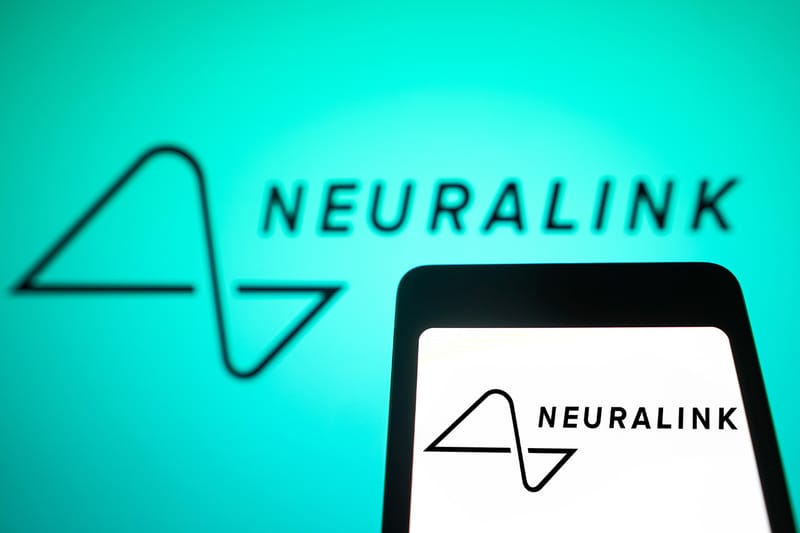 뉴럴링크의 두뇌 칩 이식환자가 생각으로 ‘마리오 카트’를 플레이했다