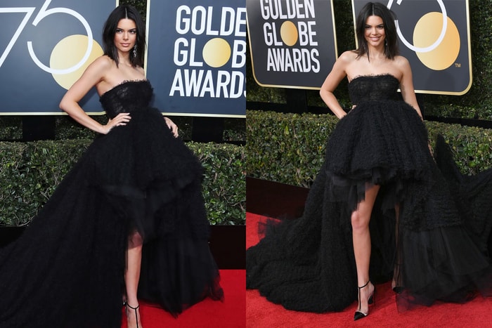 以高貴冷艷造型出席金球獎的 Kendall Jenner,竟然因為這個皮膚問題而被網民批評?
