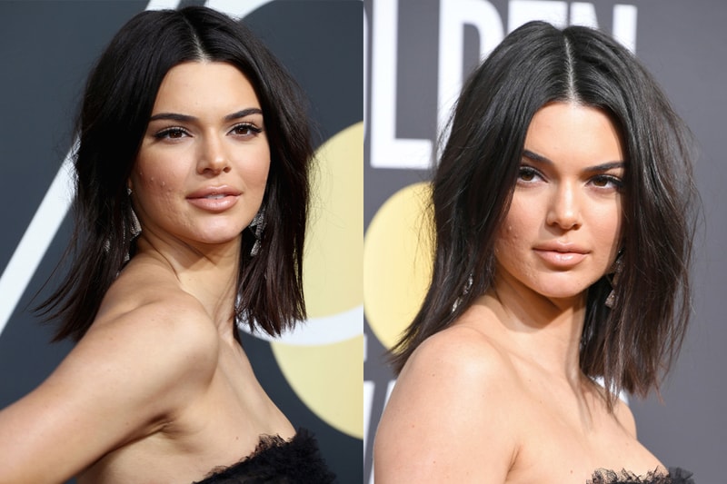 以高貴冷艷造型出席金球獎的 Kendall Jenner  竟然因為這個皮膚問題而被網民批評
