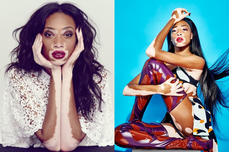 Winnie Harlow Americas next top model antm successful diesel
