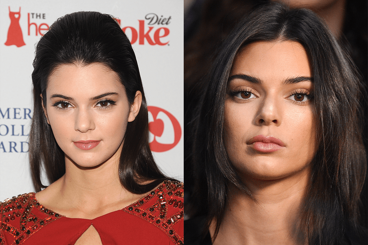Kendall Jenner lips