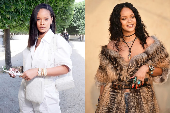 Rihanna 雖然沒有高高的「間尺鼻」，卻意外成為了最新的整容指標！