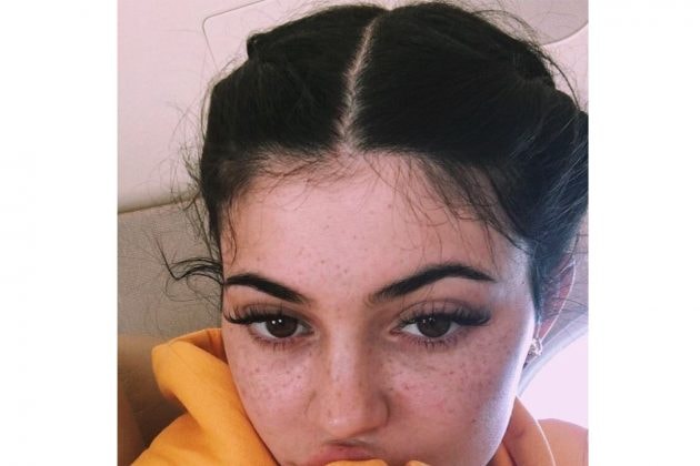 Kylie Jenner Freckles