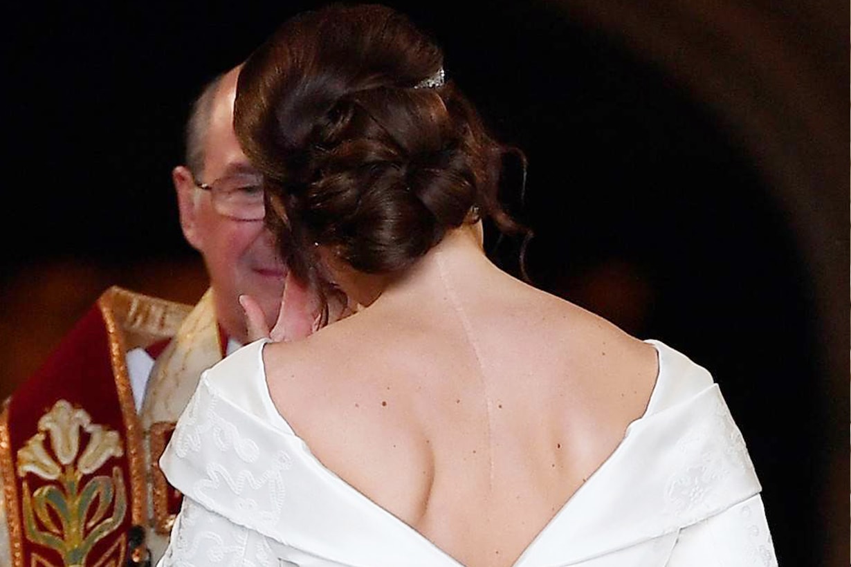Princess Eugenie British Royal family Wedding Jack Brooksbank Showing scar surgery scoliosis peter pilotto christopher de vos