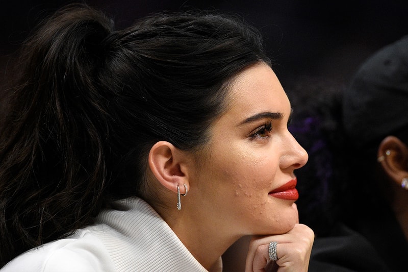 Kendall Jenner Acne
