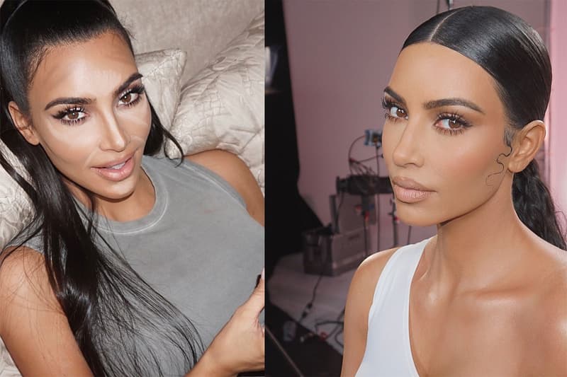 Kim Kardashian has psoriasis