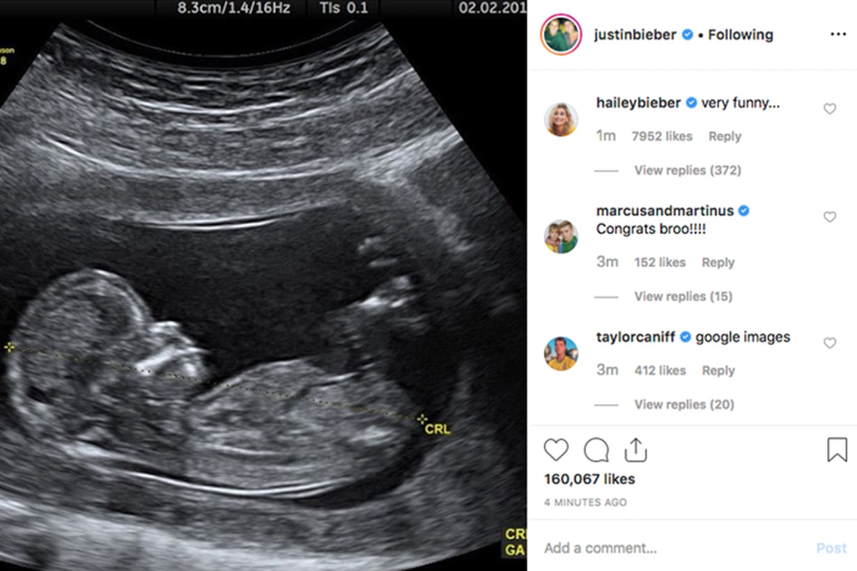 Justin Bieber Instagram Baby