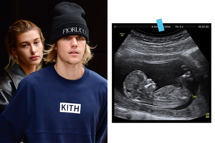 Justin Bieber 要當爸爸了？貼出寶寶超聲波照，但 Hailey 的反應很冷淡⋯