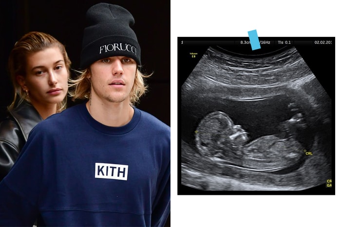 Justin Bieber 要當爸爸了?貼出寶寶超聲波照,但 Hailey 的反應很冷淡⋯