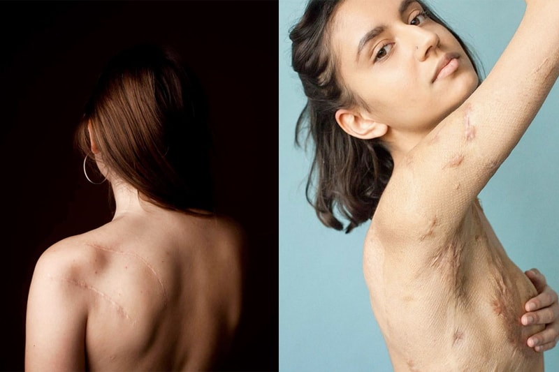 behind the scars sophie mayanne beautiful delete facebook