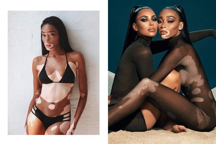 改寫審美觀:Kim Kardashian 美妝品牌找來白斑超模 Winnie Harlow 合作!