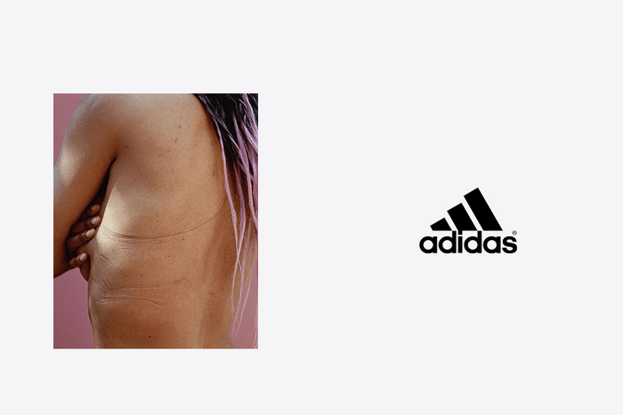 25 張裸胸照:Adidas 的全新廣告惹爭議,被指物化女性?