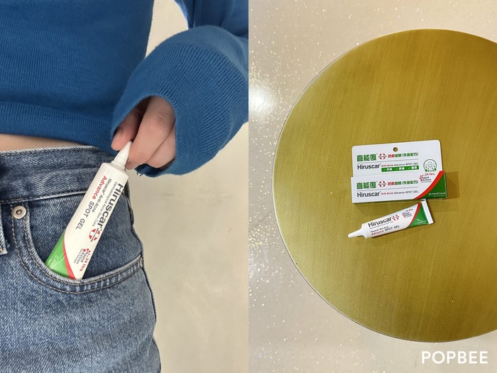 能 24 小時改善,為什麼還要等?愛美女生大推:喜能復抗痘明星商品,筆記皮膚科醫師抗痘策略!