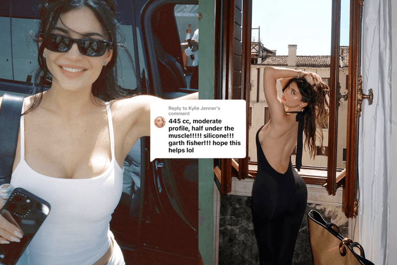 整容又何妨？Kylie Jenner 公開隆乳手術細節，像她大方做自己也是一種美！