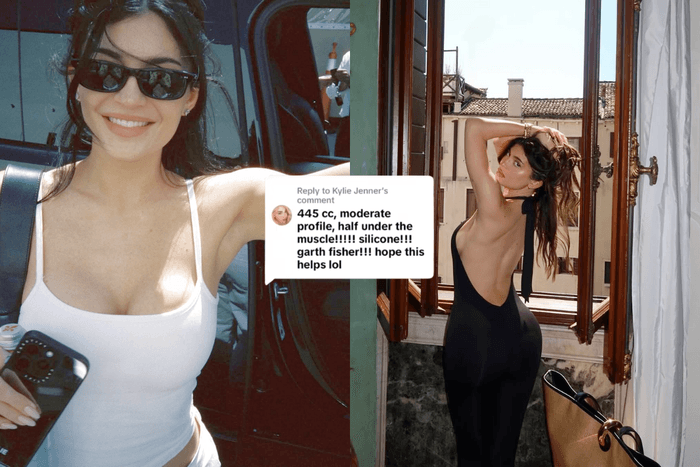 整容又何妨?Kylie Jenner 公開隆乳手術細節,像她大方做自己也是一種美!
