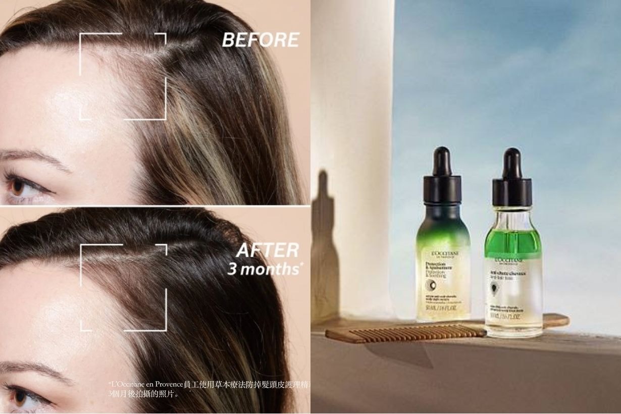 hair-care-serum-shampoo-scrub-recommendation