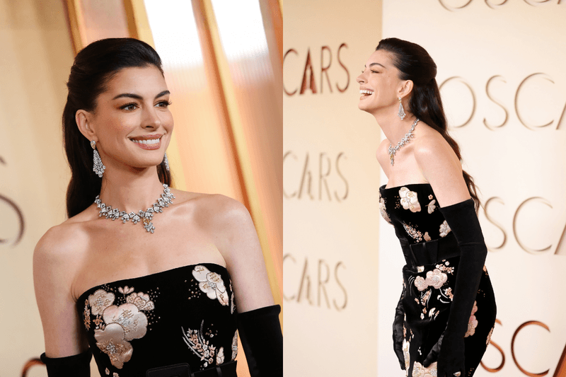 不用按摩、儀器：Anne Hathaway 不藏私，分享奧斯卡讓臉型「一秒拉提」的秘密！