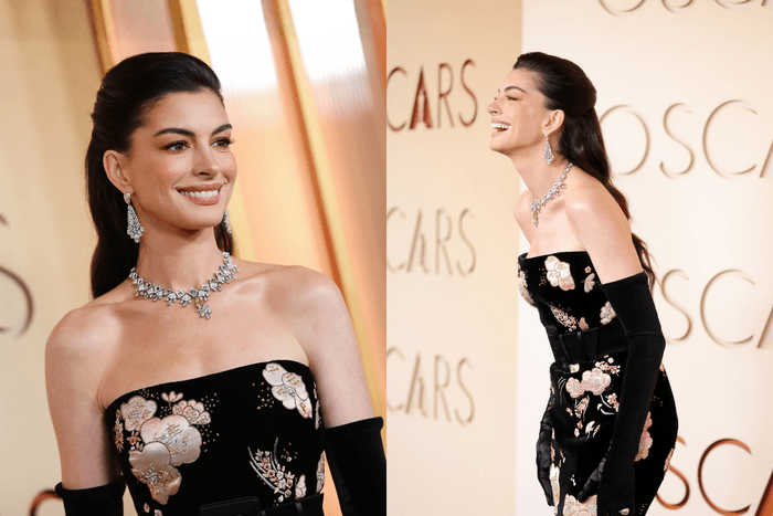 不用按摩、儀器:Anne Hathaway 不藏私,分享奧斯卡讓臉型「一秒拉提」的秘密!