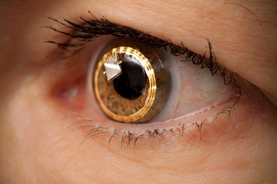 New contact lenses technology