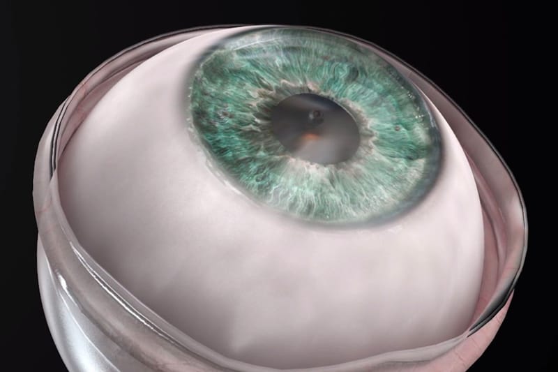CorNeat Vision 研發之人造角膜「KPro」正式成功使視障人士恢復視力