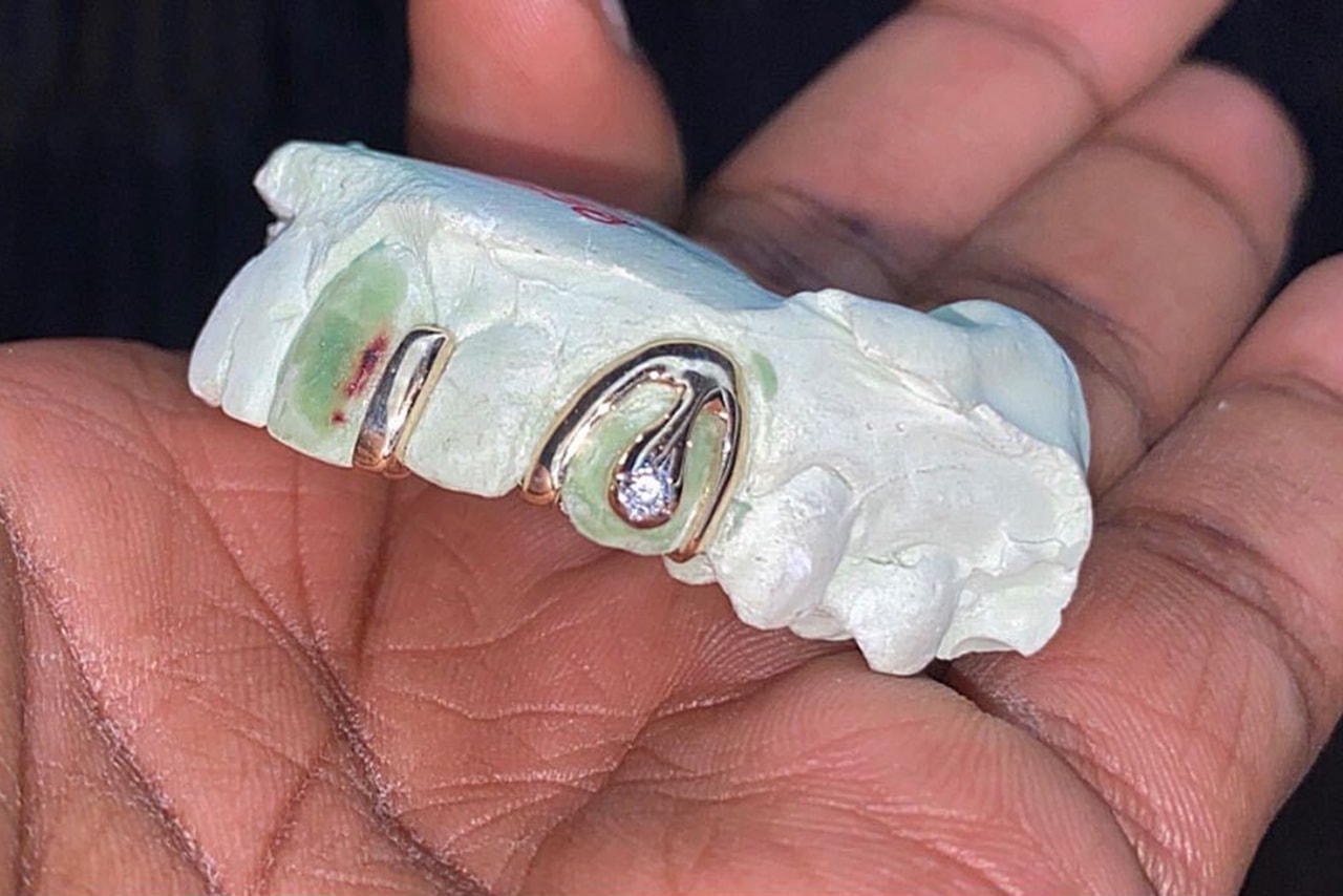 9 Grillz Styles You Should Know, Helen Harris HYPEBEAST