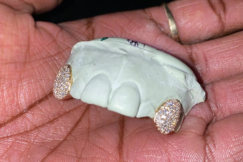 The Grillz Glozzary 10 Styles You Should Know
