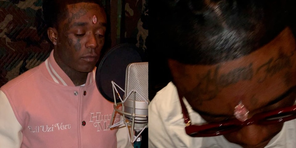 Lil Uzi Vert shows pink diamond implanted on his forehead