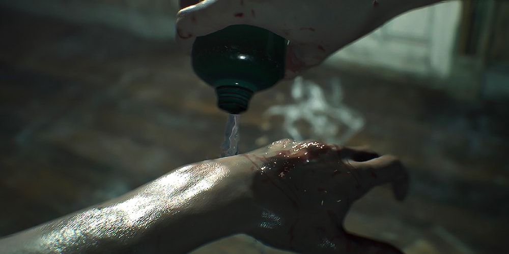 Twitter отреагировал на жестокое обращение с руками Итана Уинтерса в «Resident Evil Village»