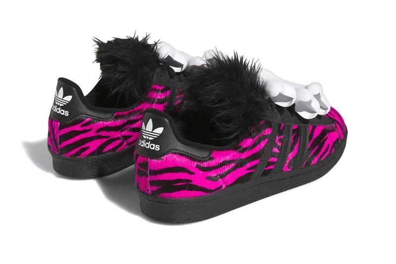 【Jeremy Scott Bones x Adidas】 Campus 80s Black ★HQ4493★ 