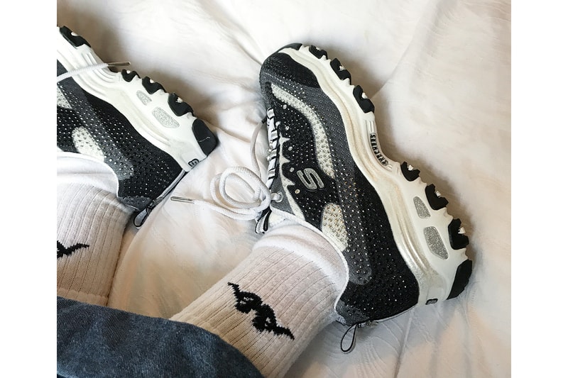 Here's Why Skechers Are the Next ItShoe Hypebae